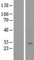 LYSMD4 Human Over-expression Lysate