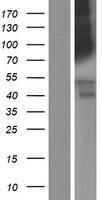 LRRN4 Human Over-expression Lysate