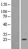TSC21 (TEX37) Human Over-expression Lysate