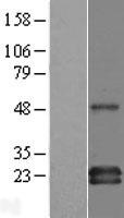 GAPT Human Over-expression Lysate