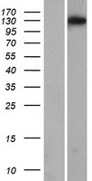 STOX1 Human Over-expression Lysate