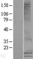 MS4A15 Human Over-expression Lysate