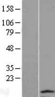 DYNLT2B Human Over-expression Lysate