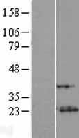 VXN Human Over-expression Lysate