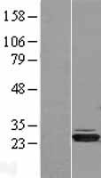 HIBADH Human Over-expression Lysate
