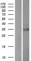 PDIK1L Human Over-expression Lysate