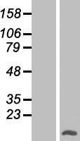 TMEM18 Human Over-expression Lysate
