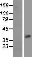 ASPRV1 Human Over-expression Lysate