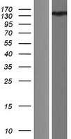 ANKS1B Human Over-expression Lysate