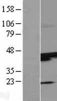 SUNC1 (SUN3) Human Over-expression Lysate