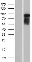 MAP7D2 Human Over-expression Lysate