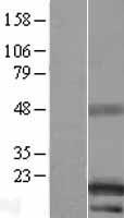 C14orf48 (LINC00521) Human Over-expression Lysate