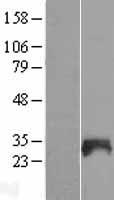 SNX21 Human Over-expression Lysate