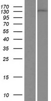 DGKD Human Over-expression Lysate