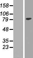 EZH2 Human Over-expression Lysate
