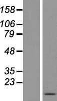 FDCSP Human Over-expression Lysate