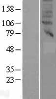 SLC47A2 Human Over-expression Lysate