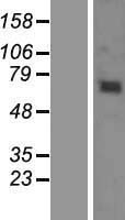 KBTBD6 Human Over-expression Lysate