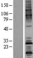 ODF4 Human Over-expression Lysate