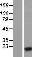 WTAP Human Over-expression Lysate