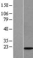 WTAP Human Over-expression Lysate