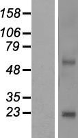 NKAIN4 Human Over-expression Lysate