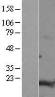 TMEM188 (CNEP1R1) Human Over-expression Lysate