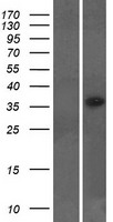 LYSMD2 Human Over-expression Lysate