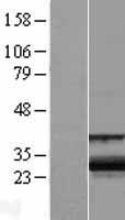 ZCCHC24 Human Over-expression Lysate