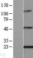 ENPP6 Human Over-expression Lysate
