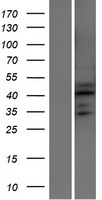 ATXN7L2 Human Over-expression Lysate