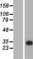 KCTD6 Human Over-expression Lysate