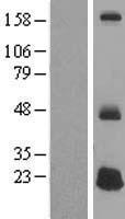 DEFB125 Human Over-expression Lysate