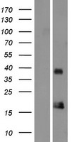 ORAV1 (ORAOV1) Human Over-expression Lysate