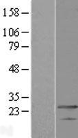 MED19 Human Over-expression Lysate