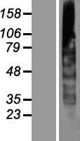 CYB561A3 Human Over-expression Lysate