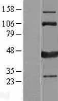 CAMK1D Human Over-expression Lysate