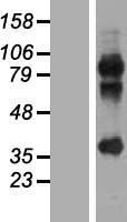 MAGEA2 (MAGEA2B) Human Over-expression Lysate