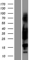 Tropomyosin 3 (TPM3) Human Over-expression Lysate