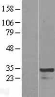 HOXC4 Human Over-expression Lysate