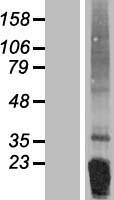 FNDC5 Human Over-expression Lysate
