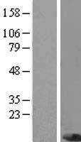 PIGC Human Over-expression Lysate