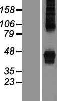 ZDHHC14 Human Over-expression Lysate