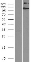 Ellis van Creveld syndrome (EVC) Human Over-expression Lysate