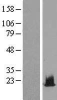 H2BC1 Human Over-expression Lysate