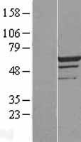 MEIS2 Human Over-expression Lysate