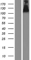 UNC5B Human Over-expression Lysate