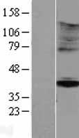 KIR5.1 (KCNJ16) Human Over-expression Lysate