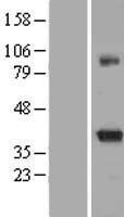 Kv beta 2 (KCNAB2) Human Over-expression Lysate