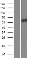 CAMK2B Human Over-expression Lysate